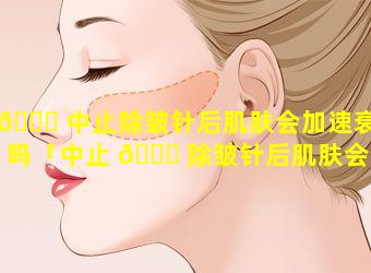 🐒 中止除皱针后肌肤会加速衰老吗「中止 🐋 除皱针后肌肤会加速衰老吗为什么」